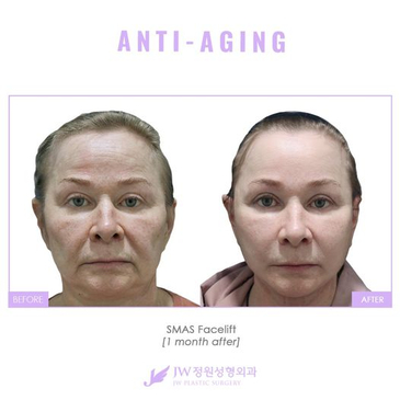 Slider image (6) JW Plastic Surgery Korea